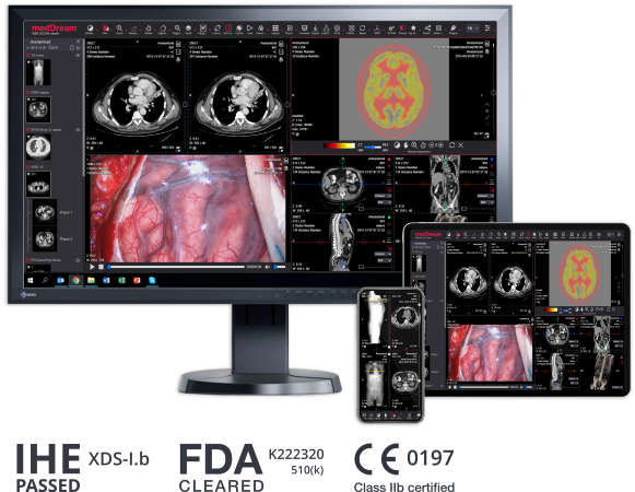 Sistema PACS | RIS PACS | SOFTWARE HISTORIA CLINICA